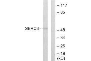 Western blot analysis of extracts from 293 cells, using SERC3 antibody. (SERINC3 Antikörper  (C-Term))