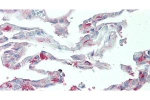 Immunohistochemistry of paraffin-embedded Human Lung tissue using SLC34A2 Polyclonal Antibody at dilution of 1:60. (SLC34A2 Antikörper)