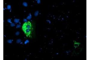 Anti-PDSS2 mouse monoclonal antibody (ABIN2455335) immunofluorescent staining of COS7 cells transiently transfected by pCMV6-ENTRY PDSS2 (RC207892). (PDSS2 Antikörper)