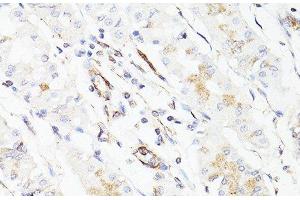 Immunohistochemistry of paraffin-embedded Human stomach using Vimentin Polyclonal Antibody at dilution of 1:150 (40x lens). (Vimentin Antikörper)