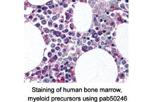 Image no. 1 for anti-Integrin alpha M (ITGAM) (AA 500-600), (Internal Region) antibody (ABIN363555)