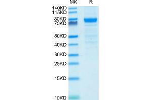 IL3RA Protein (AA 19-305) (Fc Tag)