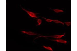 Immunofluorescence (fixed cells) (IF/ICC) image for anti-Spleen tyrosine Kinase (SYK) (pTyr348) antibody (ABIN6255895)