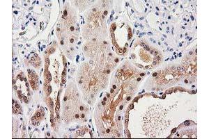 Immunohistochemical staining of paraffin-embedded Human Kidney tissue using anti-SULT1C2 mouse monoclonal antibody. (SULT1C2 Antikörper)