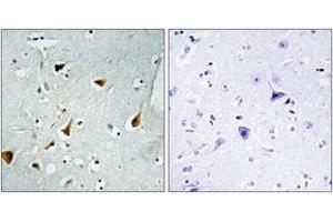 Immunohistochemistry analysis of paraffin-embedded human brain tissue, using STAT6 (Ab-641) Antibody. (STAT6 Antikörper  (AA 608-657))