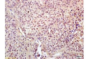 Immunohistochemistry (Paraffin-embedded Sections) (IHC (p)) image for anti-Upstream Binding Transcription Factor, RNA Polymerase I (UBTF) (AA 51-150) antibody (ABIN2179904)