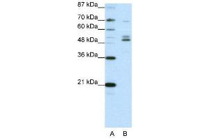 WB Suggested Anti-FOXA2  Antibody Titration: 0.