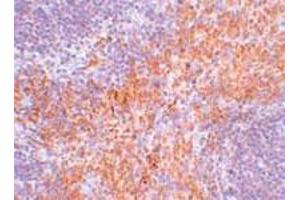 Immunohistochemical staining of mouse kidney tissue with 2. (RIPK1 Antikörper  (N-Term))
