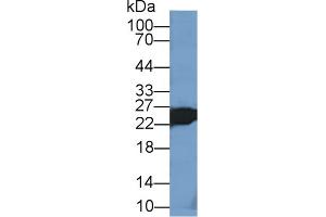 Detection of TNNI2 in Mouse Skeletal muscle lysate using Polyclonal Antibody to Troponin I Type 2, Fast Skeletal (TNNI2) (TNNI2 Antikörper  (AA 1-182))