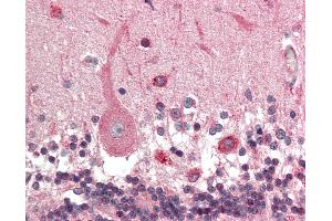 Anti-KCNN1 antibody IHC staining of human brain, cerebellum. (KCNN1 Antikörper  (AA 441-490))
