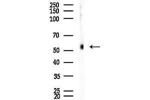 anti-Transmembrane Protease, serine 4 (TMPRSS4) (Internal Region) antibody