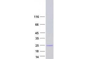 Western Blotting (WB) image for Exosome Component 3 (EXOSC3) (Transcript Variant 2) protein (Myc-DYKDDDDK Tag) (ABIN2720625)