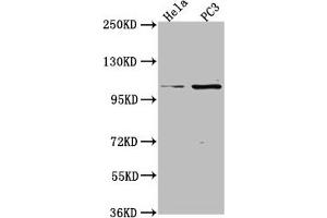 Western Blot Positive WB detected in: Hela whole cell lysate, PC3 whole cell lysate All lanes: PKN3 antibody at 1:2000 Secondary Goat polyclonal to rabbit IgG at 1/50000 dilution Predicted band size: 100 kDa Observed band size: 100 kDa (PKN3 Antikörper  (AA 1-252))
