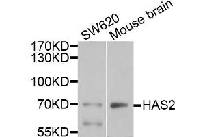 Western blot analysis of extracts of various cells, using HAS2 antibody. (HAS2 Antikörper)