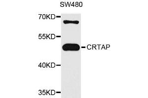 Western blot analysis of extracts of SW480 cells, using CRTAP antibody. (CRTAP Antikörper)