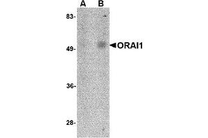 Western Blotting (WB) image for anti-ORAI Calcium Release-Activated Calcium Modulator 1 (ORAI1) antibody (ABIN1031712) (ORAI1 Antikörper)