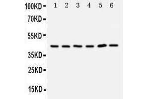 Anti-TRAM1 antibody, Western blotting Lane 1: Rat Brain Tissue Lysate Lane 2: Rat Kidney Tissue Lysate Lane 3: 293T Cell Lysate Lane 4: RAJI Cell Lysate Lane 5: JURKAT Cell Lysate (TRAM1 Antikörper  (C-Term))