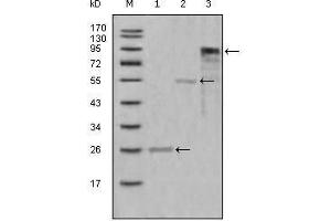 Western Blot showing MPO antibody used against truncated Trx-MPO recombinant protein (1),truncated MBP-MPO (aa1-193) recombinant protein (2) and truncated MPO (aa165-745)-hIgGFc transfected CHO-K1 cell lysate (3). (Myeloperoxidase Antikörper  (AA 1-193))