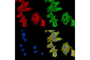 ABIN7095725 and ABIN7099787 staining Hela cells by IF/ICC.