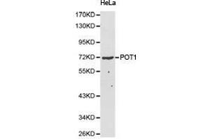 Western Blotting (WB) image for anti-Protection of Telomeres 1 (POT1) antibody (ABIN2650945) (POT1 Antikörper)