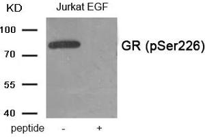 Western blot analysis of extracts from Jurkat cells treated with EGF using Phospho-GR (Ser226) antibody. (Glucocorticoid Receptor Antikörper  (pSer226))