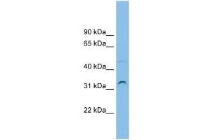 WB Suggested Anti-SECTM1 Antibody Titration: 0. (SECTM1 Antikörper  (Middle Region))