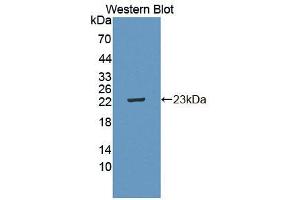 Western blot analysis of the recombinant protein. (IL21 Receptor Antikörper  (AA 23-185))