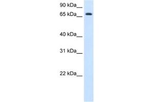 Western Blotting (WB) image for anti-Histidine Ammonia-Lyase (HAL) antibody (ABIN2462882) (HAL Antikörper)