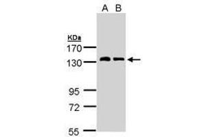 Image no. 1 for anti-Natriuretic Peptide Receptor A/guanylate Cyclase A (Atrionatriuretic Peptide Receptor A) (NPR1) (AA 640-886) antibody (ABIN467522) (NPR1 Antikörper  (AA 640-886))