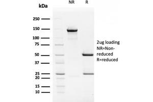 SDS-PAGE Analysis Purified TIM3 Mouse Monoclonal Antibody (TIM3/2399). (TIM3 Antikörper  (AA 22-202))