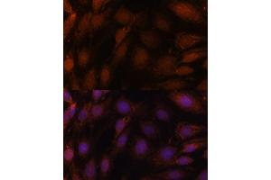 Immunofluorescence analysis of C6 cells using GCAT antibody (ABIN7267461) at dilution of 1:100. (GCAT Antikörper  (AA 170-419))