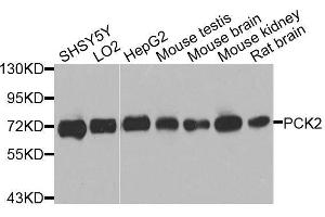 Western blot analysis of extracts of various cell lines, using PCK2 antibody. (PEPCK Antikörper  (AA 1-280))
