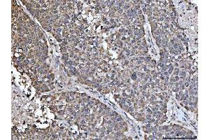 IHC analysis of NDUFS5 using anti-NDUFS5 antibody (ABIN7598943).