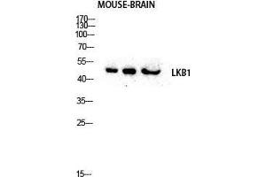 Western Blot (WB) analysis of Mouse Brain lysis using LKB1 antibody. (LKB1 Antikörper  (Tyr1313))