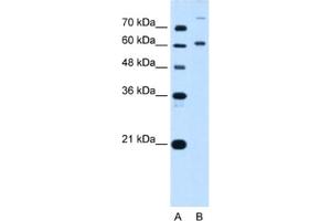 Western Blotting (WB) image for anti-BMP2 Inducible Kinase (BMP2K) antibody (ABIN2462590) (BMP2K Antikörper)