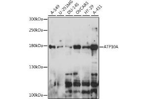 Western blot analysis of extracts of various cell lines, using A antibody (ABIN7265756) at 1:1000 dilution. (ATP10A Antikörper  (AA 440-690))