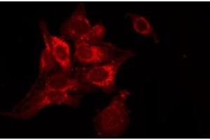 ABIN6278417 staining NIH-3T3 by IF/ICC. (TACR2 Antikörper  (C-Term))