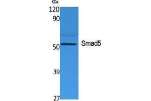 Western Blotting (WB) image for anti-SMAD, Mothers Against DPP Homolog 5 (SMAD5) (Internal Region) antibody (ABIN3178118) (SMAD5 Antikörper  (Internal Region))