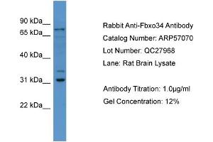 WB Suggested Anti-Fbxo34  Antibody Titration: 0. (FBXO34 Antikörper  (N-Term))