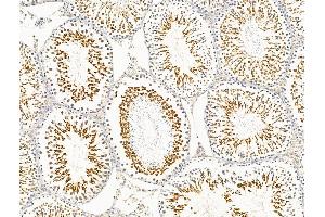 ABIN7094745 and ABIN7098796 at 1/100 staining Rat testis tissue by IHC-P. (PITX2 Antikörper  (Internal Region))