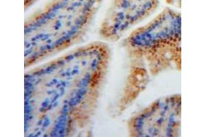 IHC-P analysis of Stomach tissue, with DAB staining. (FABP2 Antikörper  (AA 2-132))