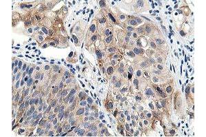 Image no. 5 for anti-Leucine Carboxyl Methyltransferase 1 (LCMT1) antibody (ABIN1499107) (LCMT1 Antikörper)