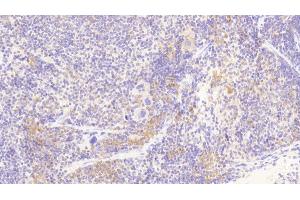 Detection of SCFR in Mouse Spleen Tissue using Polyclonal Antibody to Stem Cell Factor Receptor (SCFR)