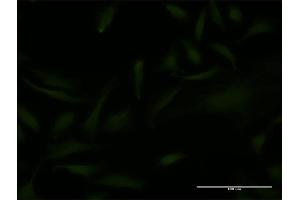 Immunofluorescence of monoclonal antibody to EMX2 on HeLa cell. (EMX2 Antikörper  (AA 103-200))