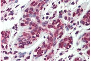 Human Breast: Formalin-Fixed, Paraffin-Embedded (FFPE) (ARL2 Antikörper  (AA 123-184))