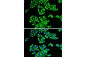 Immunofluorescence (IF) image for anti-DEAD (Asp-Glu-Ala-Asp) Box Polypeptide 3, X-Linked (DDX3X) antibody (ABIN1876838) (DDX3X Antikörper)