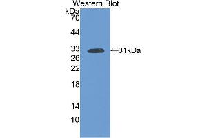 Western blot analysis of the recombinant protein. (FLT1 Antikörper  (AA 303-524))
