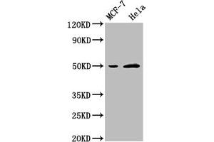 Western Blot Positive WB detected in: MCF-7 whole cell lysate, Hela whole cell lysate All lanes: SLC16A3 antibody at 1:2500 Secondary Goat polyclonal to rabbit IgG at 1/50000 dilution Predicted band size: 50 kDa Observed band size: 50 kDa (SLC16A3 Antikörper  (AA 406-465))