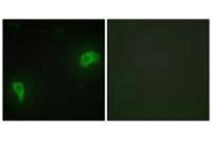 Immunofluorescence analysis of HepG2 cells, using DOK7 antibody. (DOK7 Antikörper  (N-Term))