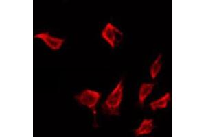 ABIN6272326 staining LOVO by IF/ICC. (IFIT1 Antikörper  (Internal Region))